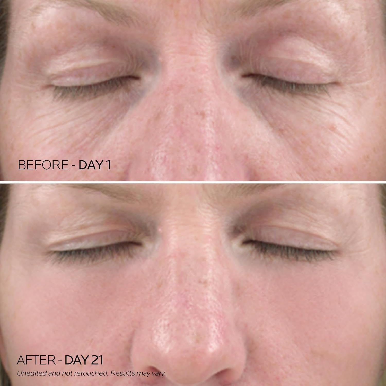 Dr. Pure Under Eye Patches for Puffiness: Caffeine Eye Mask Soothe Fine Lines Wrinkles with Niacinamide Hyaluronic Acid - Reduce Dark Circles Eye Gel Pad (30 Pairs) - Image 3